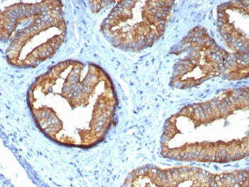 IHC staining of FFPE prostate tissue with Beta Tubulin antibody (clone TUBB/4470). HIER: boil tissue