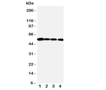 Western blot testing of MMP24 antibody and Lane 1: PANC; 2: HeLa; 3: SMMC-7721; 4: A549 cell lysate