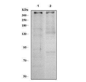 Western blot testing of human 1) HeLa and 2) RT4 cell lysate with 53BP1 antibody. Predicted molecula