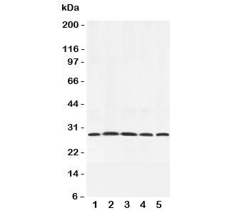 Western blot testing of Adiponectin antibody and rat samples 1: testis; 2: spleen; 3: skeletal muscl