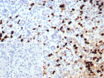 IHC staining of FFPE human spleen tissue with Calprotectin antibody (clone S100A9/7552). Inset: PBS 