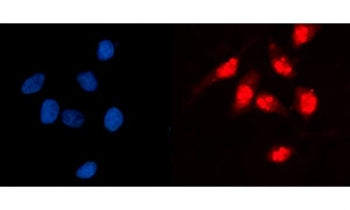 Immunofluorescent staining of FFPE human HeLa cells with Glucokinase Regulator antibody (red) and DA