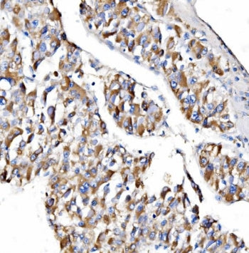 NDUFAF1 Antibody / CIA30