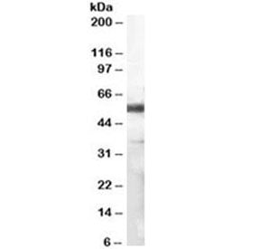 Western blot testing of human lymph node lysate with CD14 antibody at 1ug/ml. Predicted molecular we
