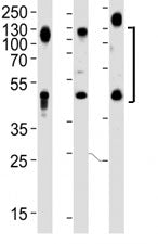 Western blot analysis of lysate from HeLa, HT1080 and human placenta lysate (left to right), using L