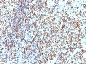 HLA-DRB1 Antibody (MHC II)