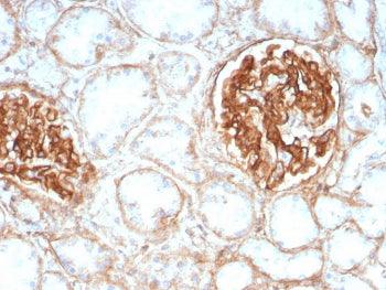 TAG-72 Antibody