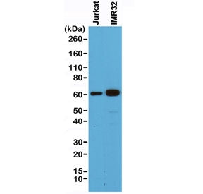 Western blot of human Jurkat and IMR32 cell lysate using recombinant SMAD4 antibody at 1:500. Predic