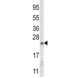 NQO2 Antibody