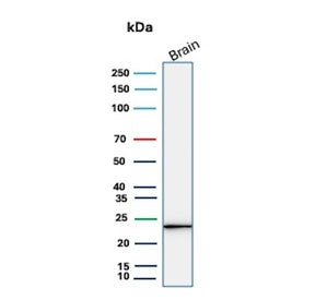 Western blot testing of human brain tissue lysate with UchL1 antibody. Predicted molecular weight ~2