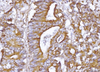 ABP1 Antibody / Amiloride binding protein 1