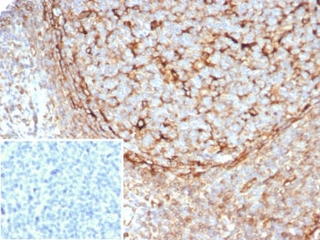 STING1 Antibody / TMEM173 / ERIS / MITA
