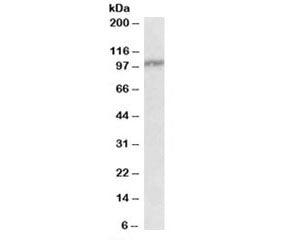 Western blot testing of peripheral blood lymphocyte lysate with IL12RB1 antibody at 0.3ug/ml. Predic