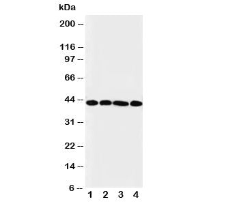 Western blot testing of IL3RA antibody and Lane 1: A431 cell lysate ; 2: SMMC-7721; 3: U87; 4: 293T 