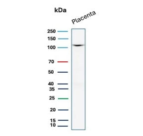 Western blot testing of human placental tissue lysate with recombinant CDH1 antibody. Expected molec