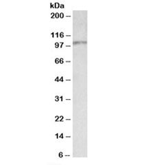 Western blot testing of rat liver lysate with Itih4 antibody at 0.03ug/ml. Predicted molecular weigh