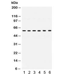 Western blot testing of 1) rat heart, 2) rat brain, and human 3) HeLa, 4) 22RV1, 5) U87 and 6) Jurka
