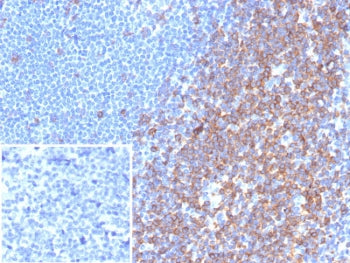 IHC staining of FFPE human tonsil tissue with CD7 antibody (clone rCD7/6972). Inset: PBS used in pla