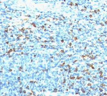 IHC staining of human tonsil with biotinylated lambda light chain antibody followed by anti-Biotin a