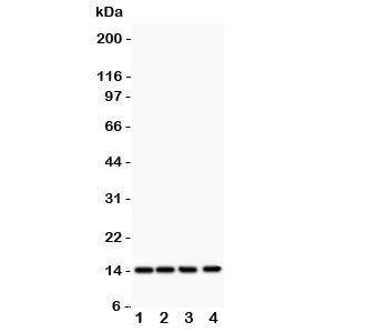 Western blot testing of PDGF-B antibody and Lane 1: rat heart; 2: (r) brain; 3: mouse heart; 4: huma