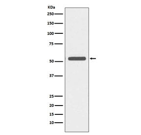 Western blot testing of human A431 cell lysate with Cytokeratin 6 antibody. Predicted molecular weig