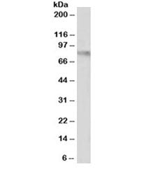 Western blot testing of human uterus lysate with VCAM antibody at 1ug/ml. Expected molecular weight: