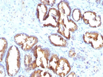 PSAP Antibody / Prostate Specific Acid Phosphatase