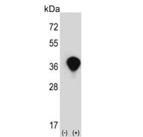 Western blot testing of 1) non-transfected and 2) transfected 293 cell lysate with Transaldolase ant