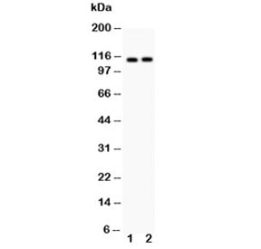 Western blot testing of ATP2A2 antibody and Lane 1: rat skeletal muscle; 2: mouse skeletal muscle; E