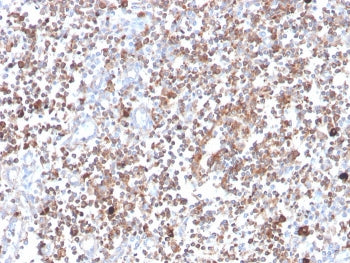 PRKCA Antibody / PKC alpha