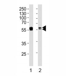LYN Antibody