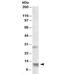 Western blot testing of human heart lysate with RNF7 antibody at 1ug/ml. Predicted molecular weight:
