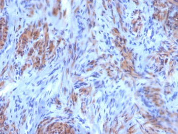 SMMHC Antibody / Smooth Muscle Myosin Heavy Chain