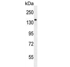 Western blot testing of human NCI-H460 cell lysate with Phospholipase C-L2 antibody. Predicted molec