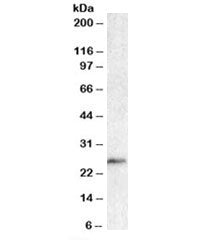 Western blot testing of human lymph node lysate with BCL7A antibody at 1ug/ml. Predicted molecular w