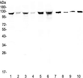 Western blot testing of human 1) HeLa, 2) placenta, 3) COLO-320, 4) HepG2, 5) SGC-7901, 6) Jurkat, 7