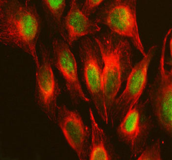 Immunofluorescent staining of RPS19BP1 using anti-RPS19BP1 antibody (green) and anti-Beta Tubulin an