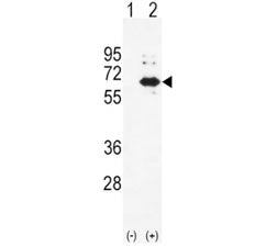 Western blot analysis of Alkaline Phosphatase antibody and 293 cell lysate (2 ug/lane) either nontra