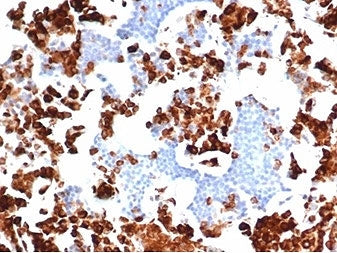 IHC staining of FFPE human bone marrow with recombinant MPO antibody (clone rMPO/6904). HIER: boil t