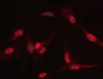 Immunofluorescent staining of FFPE human U-87 MG cells with PGK antibody. HIER: steam section in pH6
