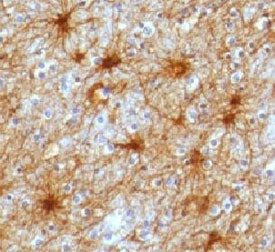 GFAP Antibody / Glial Fibrillary Acidic Protein