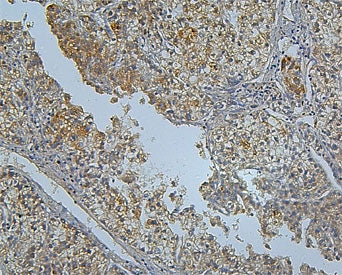 PCSK9 Antibody