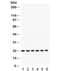 RAB10 Antibody