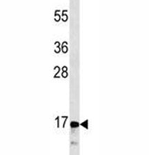 Calcitonin Antibody / CALCA / CGRP, 0.4ml