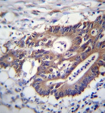 KRT12 Antibody / Cytokeratin 12