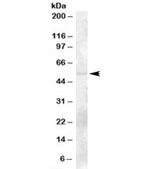 Western blot testing of human bone marrow lysate with TZFP antibody at 2ug/ml. Predicted molecular w
