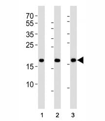 HMGA2 Antibody