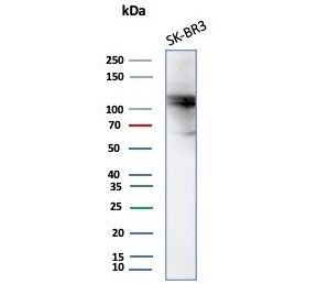 Western blot testing of human SK-BR-3 cell lysate with ADH1L1 antibody (clone ALDH1L1/7701). Predict