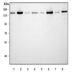 TPP2 Antibody / Tripeptidyl-peptidase 2