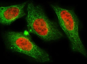 Immunofluorescent staining of FFPE human HeLa cells with MNAT1 antibody (red) and Beta Tubulin mAb (